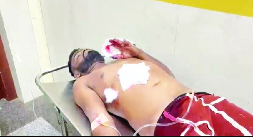 “ಸ್ನೇಹಿತರಿಂದಲೇ ಸ್ನೇಹಿತನ ಕೊಲೆಗೆ ಯತ್ನ ಮದ್ಯ ಕುಡಿಸಿ ಕರೆದೊಯ್ದು ಚಾಕು ಇರಿತ”