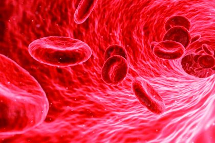 ಹಿಮೋಫಿಲಿಯಾ?